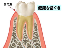 健康な歯